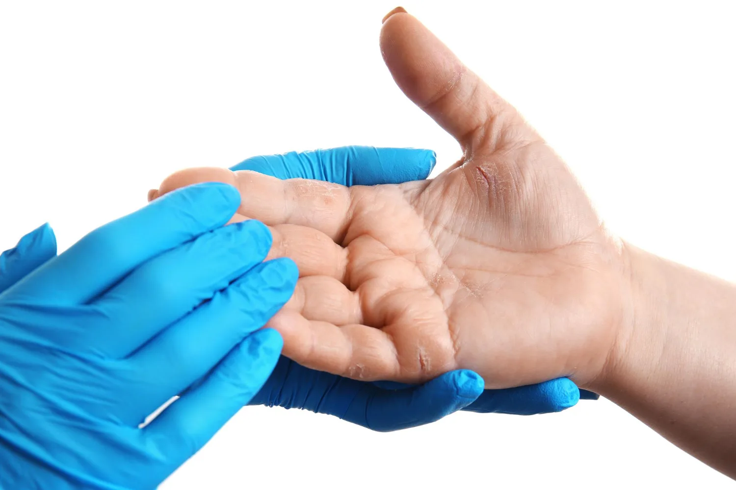 Cirugía de mano en Guadalajara: Recupera la funcionalidad con EBM Servicios Ortopédicos Profesionales